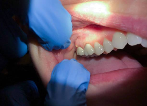 Best Emergency Treatment for Jaw Pain or Injury in Northampton, MA