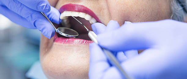 Best Dental Abscess Treatment in Northampton, MA